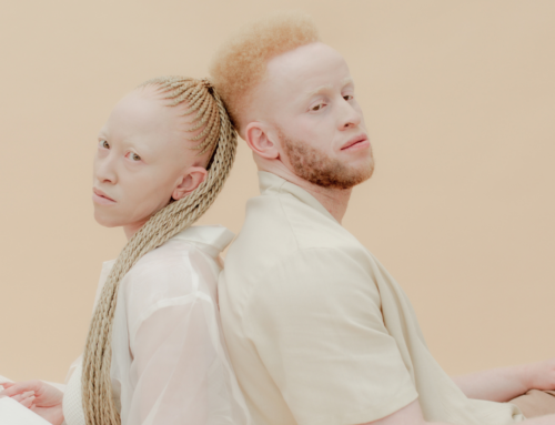 The Science of Being Stared At: What Adverse Childhood Experiences Tell Us About Growing Up with Albinism